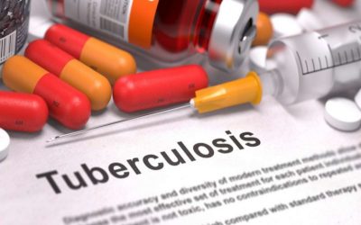 Zimbabwe runs short of Drug Sensitive TB treatment