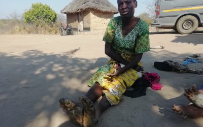 Rare health condition cripples family in Nyanga