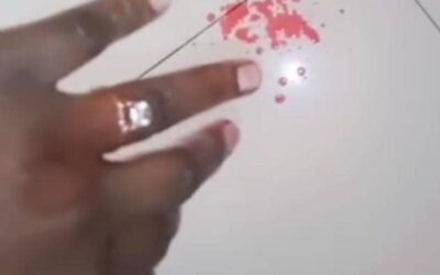 Woman in fear, as wedding ring tightens grip