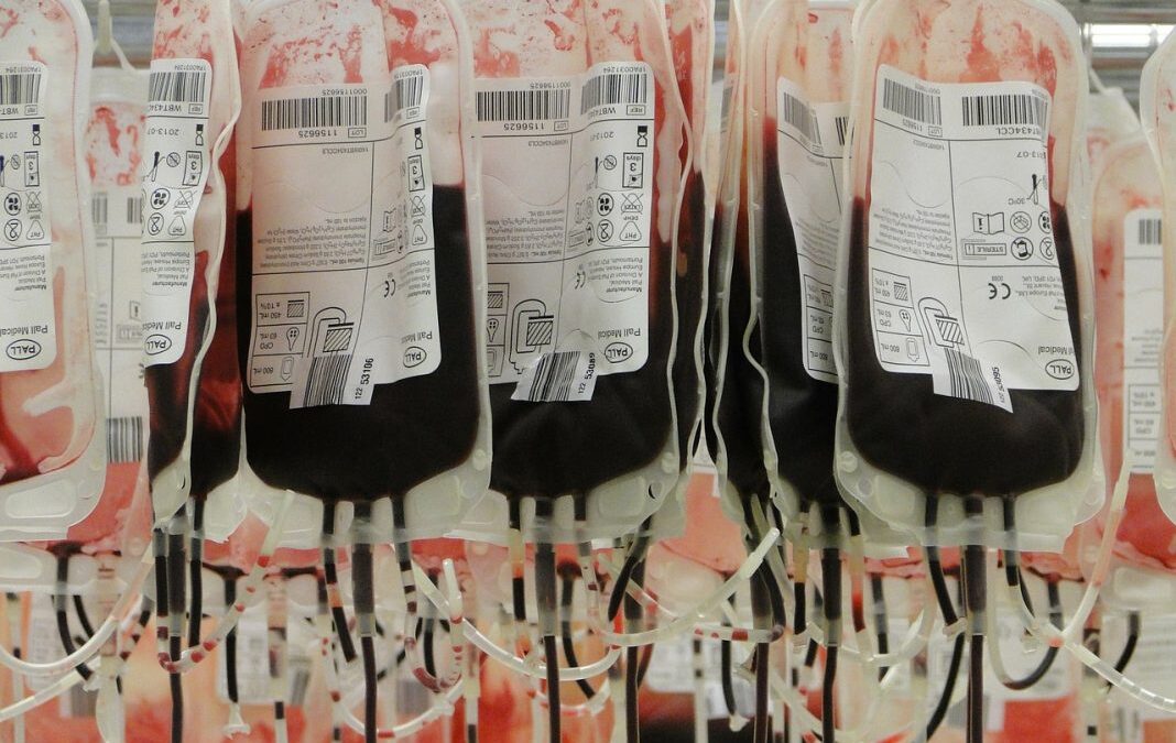 Zimbabwe runs out of blood group ‘O’ stock: NBSZ