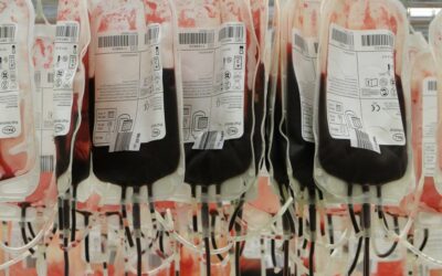 Zimbabwe runs out of blood group ‘O’ stock: NBSZ