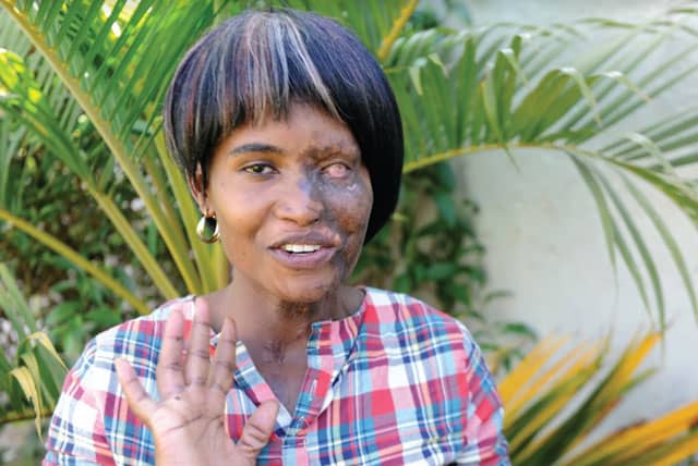 Man Remanded in Custody After Attacking Wife with Acid