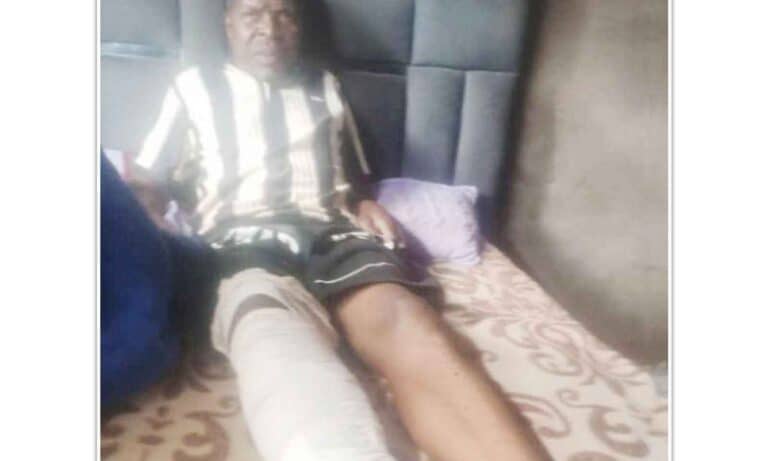 Sungura Legend Paradzai Mesi Needs Help After Hit-and-Run